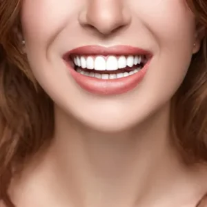 Αισθητική οδοντιατρική